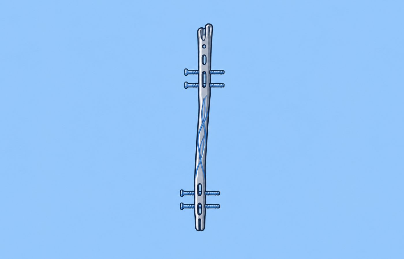 Meduloc Raises $4M Series B to Launch FDA-Cleared Fracture Fixation Platform