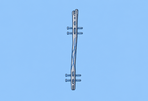 Meduloc Raises $4M Series B to Launch FDA-Cleared Fracture Fixation Platform